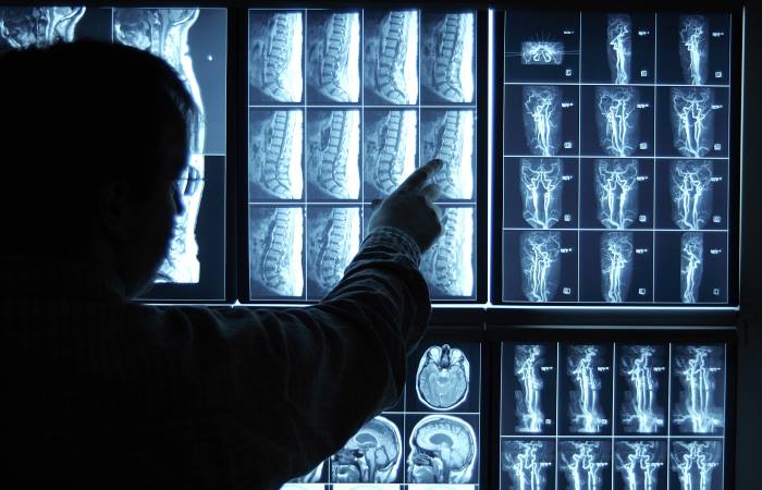 multiple diagnostic radiology claims